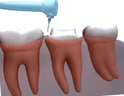 dental