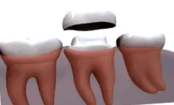 dental