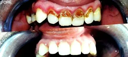 dental