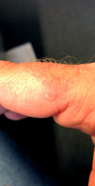fagyasztó
