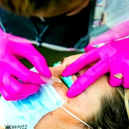 cryolipoliza