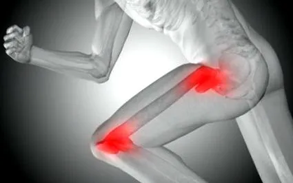 osteoarthritis csípőízületi