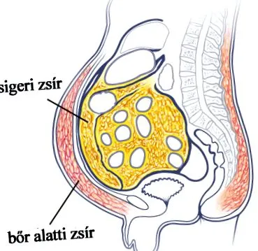 spate îndepărtează