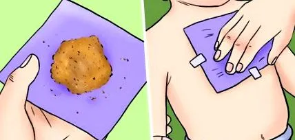 брзо