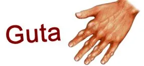 guta-ról