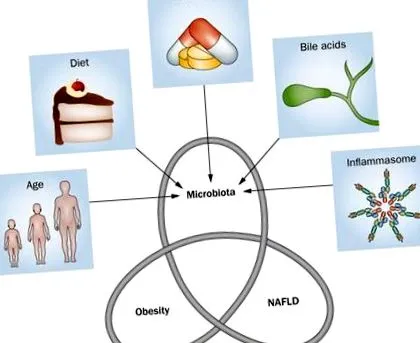 nafld