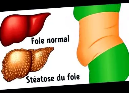 méregtelenítése