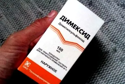 компресирајте остеоартритис