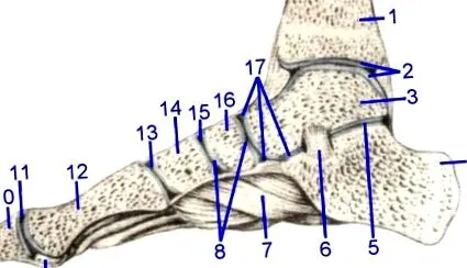 osteochondrosis