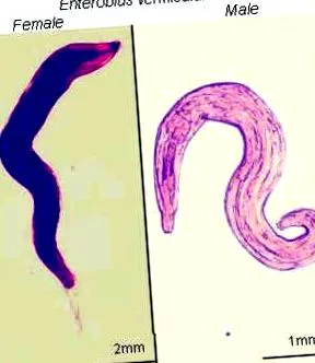 enterobius