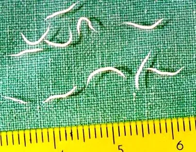 pinworms