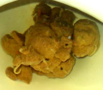difflobotriasis