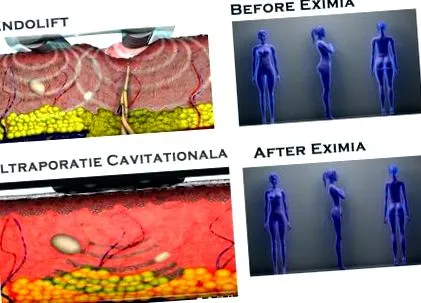 eximia eximia