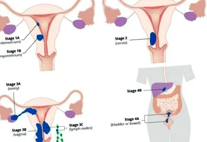 endometrium