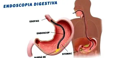 diagnosztizálásában