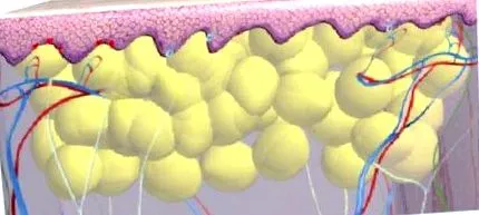 cryolipoliza