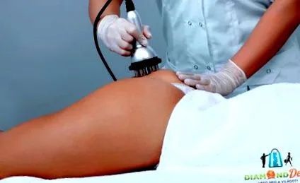 стимулация счупване