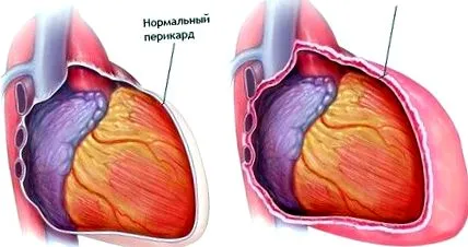 кост болката