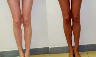 túlzott