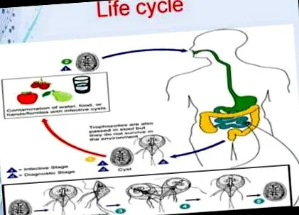 giardiasis