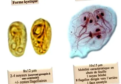 giardia