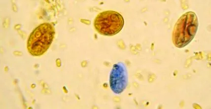 giardia