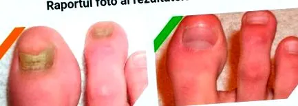 попуст попуст