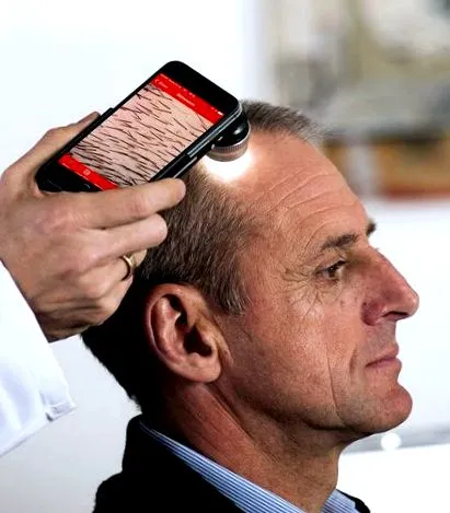 dermatoskop smartphone
