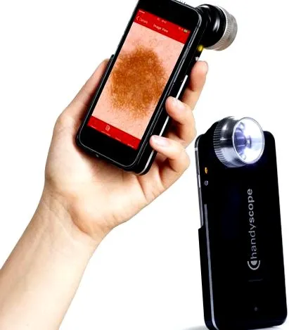 smartphone dermatoskop