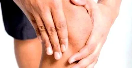 gonarthrosis gonarthrosis