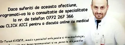 immobilizáló