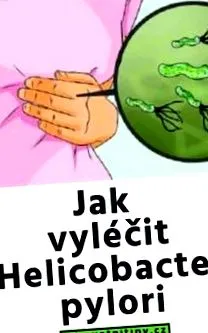 izomparaziták