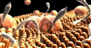 helminths