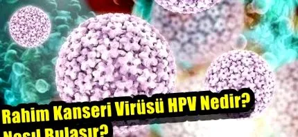 nedir saca