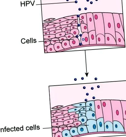 emberi