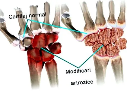 carpalis