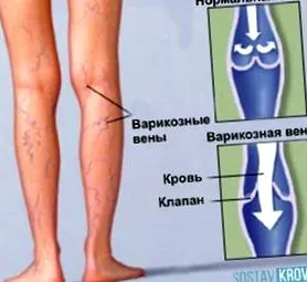 треска гъска