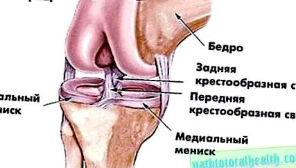 коляното артроза