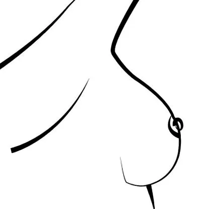 implantátum