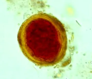 papilloma vírus