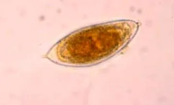 neuroendokrin papilloma