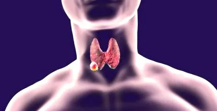 papillomavírus