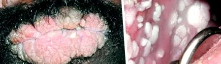 јазик