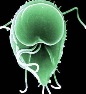 pete представлява