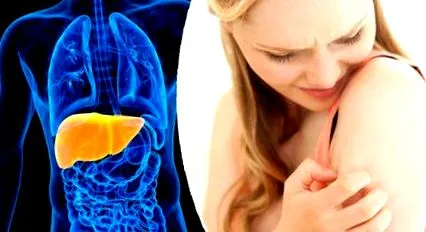 hepatitis vírus