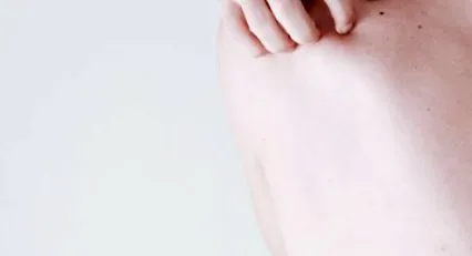 bioderma