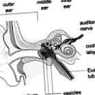 adenoiditis