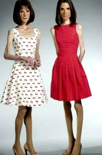 anorexia