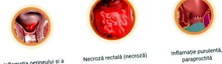 által