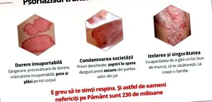 мислење лекарите